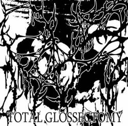 Total Glossectomy